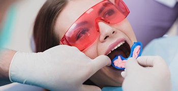Fluoride treatment